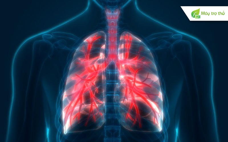 Bạn có đang mắc một số quan niệm sai lầm về COPD?